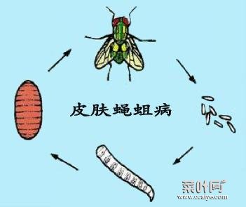 皮蝇是如何进入皮肤的 史上最恶心蝇蛆病