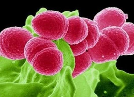 十大最可怕细菌排行榜，结核分枝杆菌是全球性的问题，链球菌会导致炎症