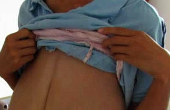 世界上乳房下垂最严重的女人:掉到腰部？像泄气的皮球