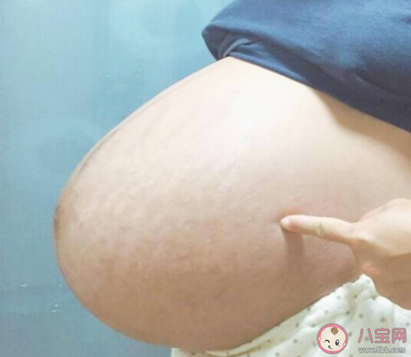 孕妇悬浮肚分娩有什么困难的 怀孕悬浮肚的原因是什么