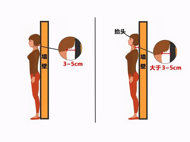2个动作改善含胸驼背（用一个动作判断）(1)