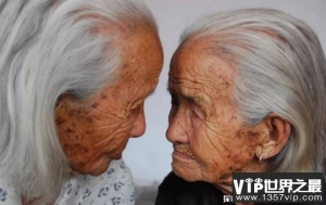 世界上最长寿双胞胎 来自中国山东都活了105岁(感情很好)