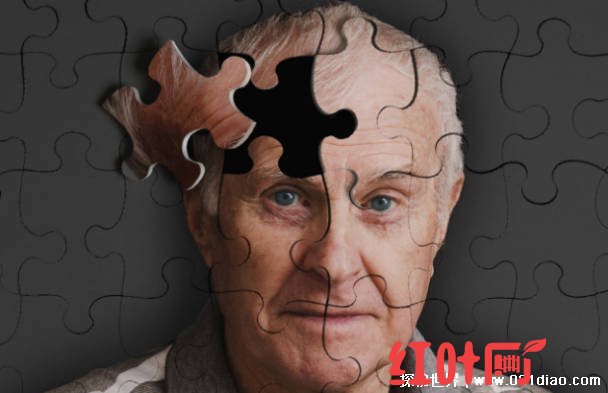 未来十年能攻克的三大疾病 阿尔茨海默氏症(可以治疗)
